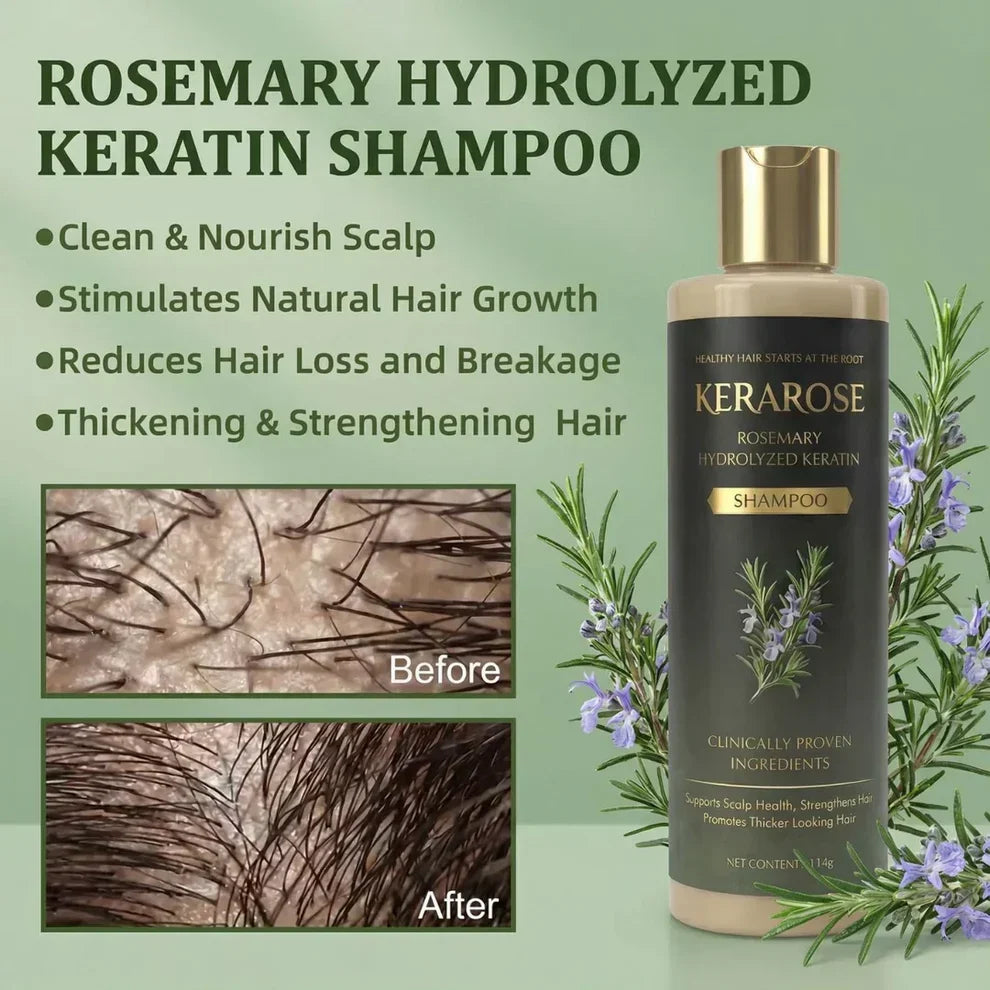 Kerarose Rosemary Hair Growth Shampoo – Rosemary + Keratin | Strengthens Hair & Supports Growth | Buy 1 Get 1 FREE