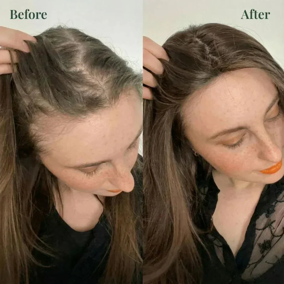 Kerarose Rosemary Hair Growth Shampoo – Rosemary + Keratin | Strengthens Hair & Supports Growth | Buy 1 Get 1 FREE